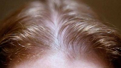 وصفات للشعر الخفيف والمتساقط.. حافظى على تاج جمالك من الضياع 