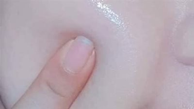 وصفات لتبيض الوجه.. زيت الورد واللافندر من أجل وجه مشرق 