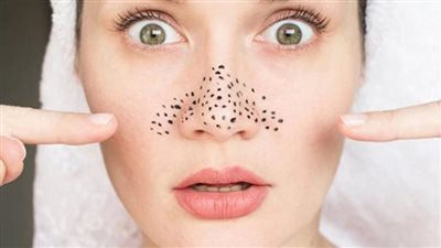 ماسك لإزالة الرؤوس السوداء من أول استعمال.. اعتمديه داخل المنزل