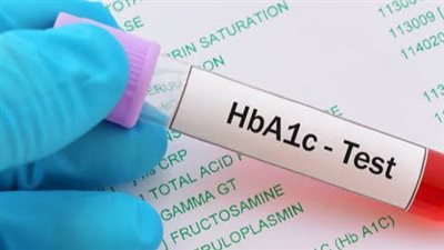 10 نصائح لمرضى السكري.. اتبعها تعيش في سلام 