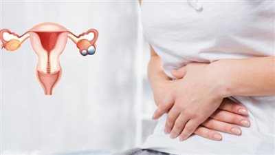 كيف ينزل تكيس المبايض؟.. 10 وسائل طبيعية وعشبية جربيها ولن تندمي