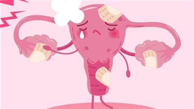 أعراض ضعف التبويض.. 6 علامات انتبهي لها وراقبي الدورة الشهرية