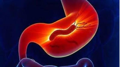 اعراض جرثومة المعدة النفسية.. الاكتئاب ابرزها 