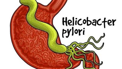 أعراض جرثومة المعدة الخطيرة.. تسبب القرحة الشديدة 