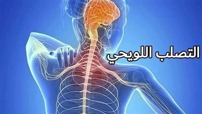 الفرق بين التصلب الجانبي الضموري واللويحي.. تعرف على الاختلاف 