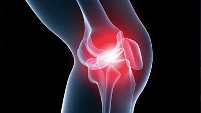 أفضل علاج لخشونة الركبة.. الغير جراحى يساعد على الشفاء  