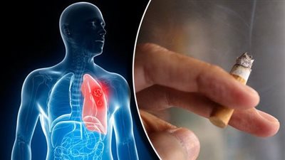 أضرار التدخين على الجهاز التنفسي.. اخطرها السرطان 