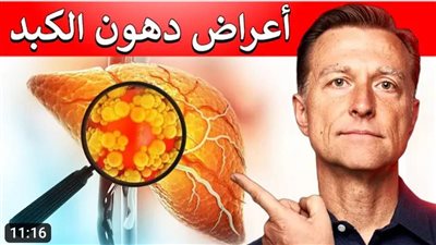 الوقاية من دهون الكبد.. ابتعد عن السمنة وراقب وزنك