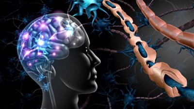  التصلب اللويحي.. أعراضه وطرق التشخيص ومخاطره