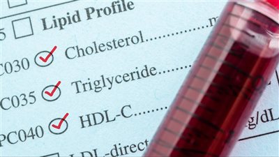 20 علامة من أعراض الدهون الثلاثية.. إليكم مستويات دهون الدم الطبيعية 