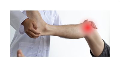 التهاب المفاصل التفاعلي.. تعرف على متلازمة ريتر