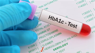 المعدل الطبيعي لـ تحليل السكر التراكمي.. جدول النتائج للمرضى والغير مصابين 