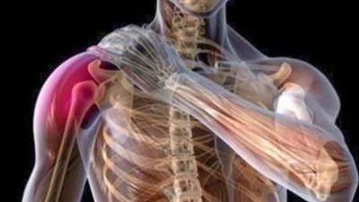علاج خلع الكتف.. إلجأ إلى طبيبك فورا 