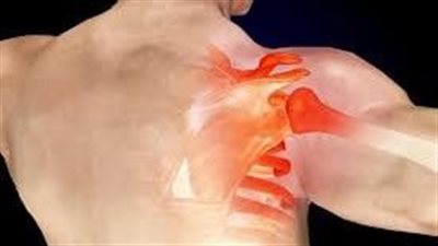 أعراض تيبّس مفصل الكتف.. الآم شديدة مع قلة الحركة