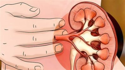 أبرزها اضطرابات نظام القلب وضعف العضلات.. أعراض نقص البوتاسيوم بالجسم