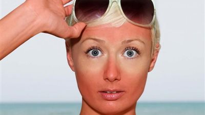 حروق الشمس في المصيف.. كيف تحدث؟