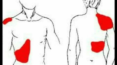 وظيفة المرارة في جسم الانسان.. تعرف على تاثيرات استئصالها 