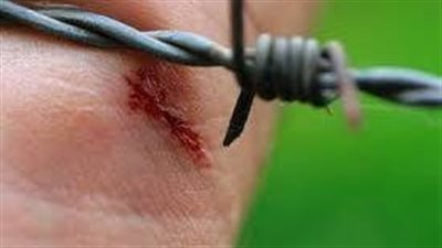 أسباب التيتانوس.. احذر اهمال جروحك