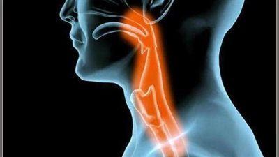 علاج التهاب الحلق.. بالاعشاب والدواء يمكن التغلب عليه