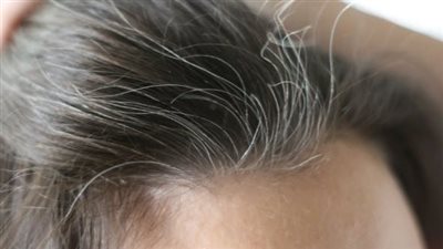 علاج الشعر الأبيض المبكر نهائيا.. فيتامينات ووصفات طبيعية فعالة