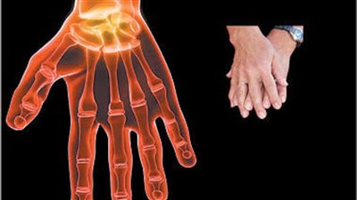 علاج الروماتويد  المفصلي.. أيهما أفضل البيولوجي أم الكيميائي؟