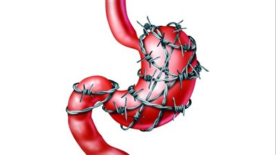 ألم فم المعدة..الاسباب وطرق العلاج المناسبة