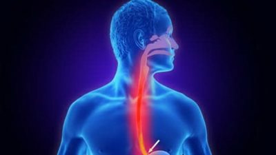 ألم المعدة المستمر.. الاسباب البسيطة وعلاجها