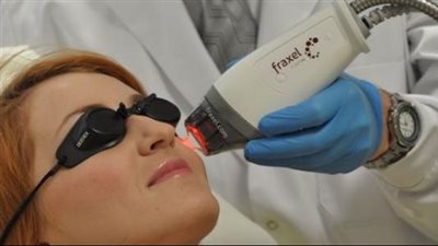 إزالة حب الشباب بالليزر للوجه.. تعرفي على الخطوات والفوائد التجميلية 