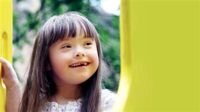 علامات متلازمة داون.. احتياطات واجبه عند ظهور علاماته