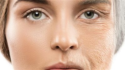 أسباب تجاعيد الوجه المبكرة.. 6 عوامل محفزة أبرزها التدخين والأرق