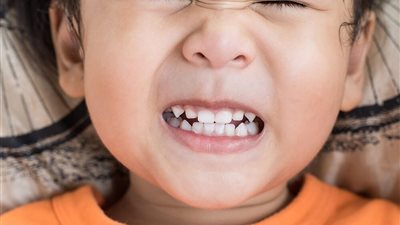 أسباب ضعف الأسنان عند الأطفال.. أهمها عدم العناية بالنظافة