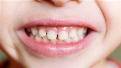 الوقاية من صرير الأسنان.. تثبيت مواعيد نوم طفلك