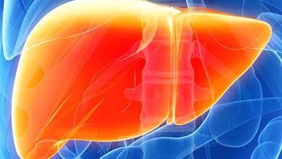 أسباب استسقاء البطن.. التهاب الكبد الوبائي أبرزها