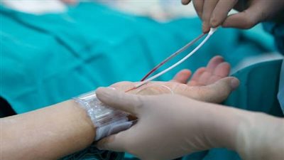 ما هي مدة البقاء في المستشفى بعد قسطرة القلب؟