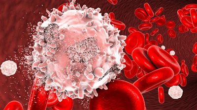 ماهو مرض HLH؟.. أعراض الإصابة بمرض البلعمة 