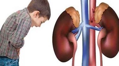 أعراض الفشل الكلوي عند الأطفال.. لاحظى نقص إنتاج البول لديه