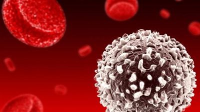 علاج ارتفاع كرات الدم البيضاء بمضادات القلق والتوتر