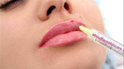 تغير لون الشفاه.. هل له علاج؟