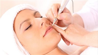 توريد الشفاه بالميزوثيرابي والفيلر.. تقنيات من أجل مظهر أجمل