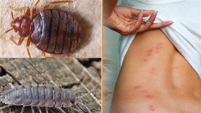 يعد وسم #بق_الفراش.. القصة الكاملة للحشرة الماصة للدماء؟