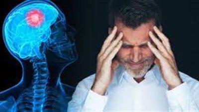 هل ينتشر ورم المخ الحميد؟.. الاطباء يؤكدون: لا داعي للقلق 