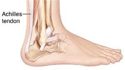 التهاب وتر الأخيل.. لا تستخدم قدميك بشكل خاطئ