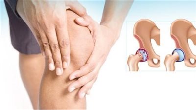 سبب التهاب المفاصل المفاجئ.. تعرف عليه قبل اليوم العالمي لالتهاب المفاصل