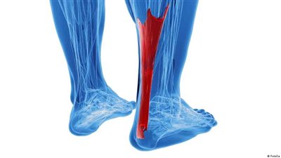 ما هو وتر أكيلس؟.. وما أسباب تمزقه؟