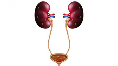 أسباب كثرة التبول في الشتاء.. عدم الحركة  ابرزها