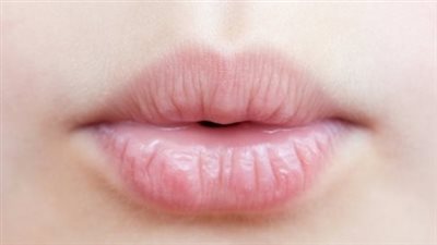 ما هي الأمراض التي تسبب تشقق الشفاه؟. 7 حالات مرضية بعضها خطير