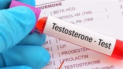 متلازمة كلاينفلتر ما هي؟.. وما اعراضها؟