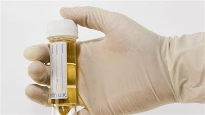 علاج صديد البول للمرضعات.. نصائح منزلية وأفضل مضادات حيوية 