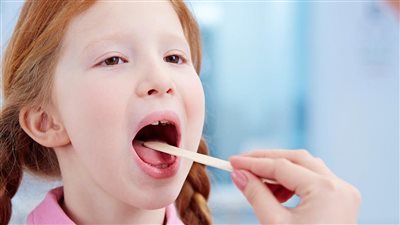 أدوية علاج التهاب الحلق.. علاجات الالتهاب الفيروسي والبكتيري