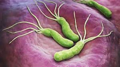 أكلات مضرة لمرضى جرثومة المعدة